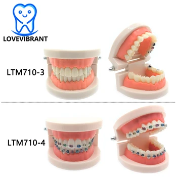 Dantų Metalo Skliausteliuose Ortodontinis modeliai Ertmės ėduonis modelius, Studentų Mokymosi, Mokymo, mokslinių Tyrimų Gydytojas-paciento Bendravimas